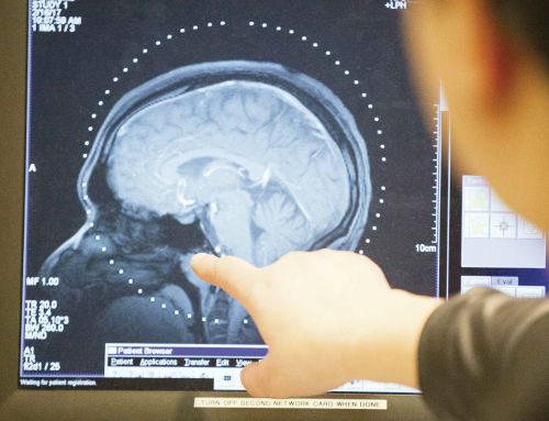 Estudio inédito publicado en la prestigiosa revista Brain